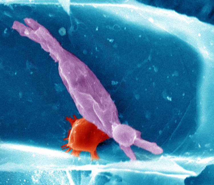 SEM of a barley leaf epidermal cell infected with the powdery mildew casual agent, Blumeria f. sp. graminis (false coloured: barley cell wall, blue; papillae, red; fungal haustorium, purple). Courtesy of Alan Little. (Douchkov et al. pp. 421-433 & Chowdhury et al. pp. 434-443)