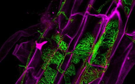 A poplar root colonized by endophytic and ectomycorrhizal fungi. Fungal hyphae are stained in green and root cells are false coloured in magenta.